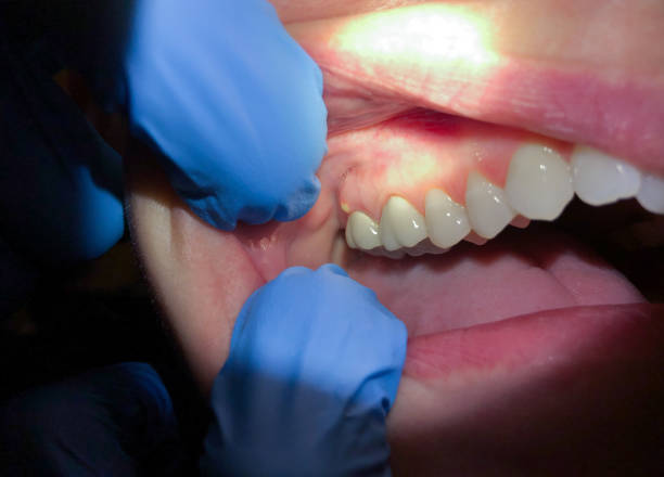 Best Emergency Denture Repair in Oak View, CA
